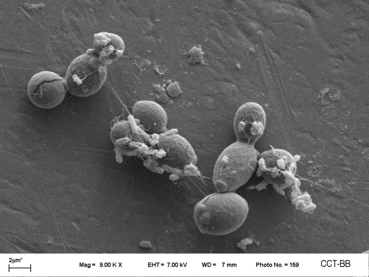 MICROBIOLOGIA Interacciones levadura-bacteria - Brugnoni
